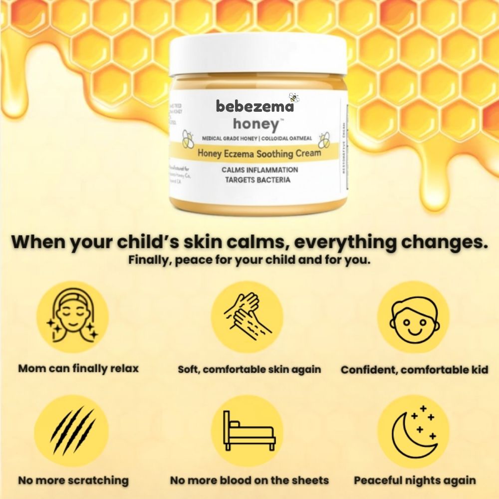 Bebezema Honey Eczema Soothing Cream