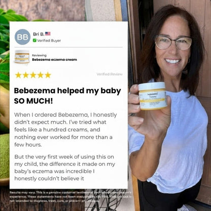 Bebezema Honey Eczema Soothing Cream