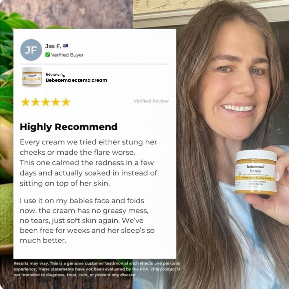 Bebezema Honey Eczema Soothing Cream